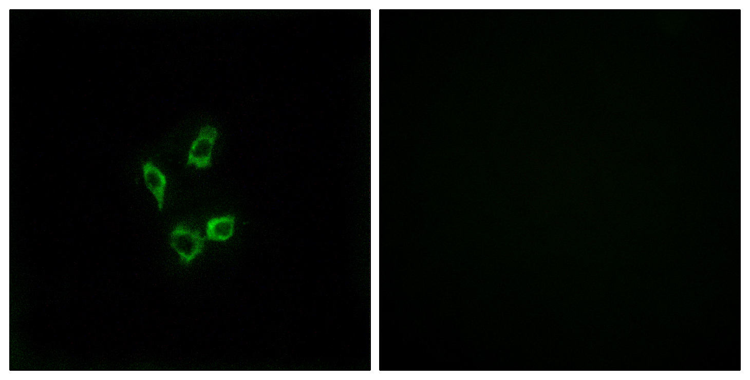 Anti-Cytochrome P450 4Z1 Antibody