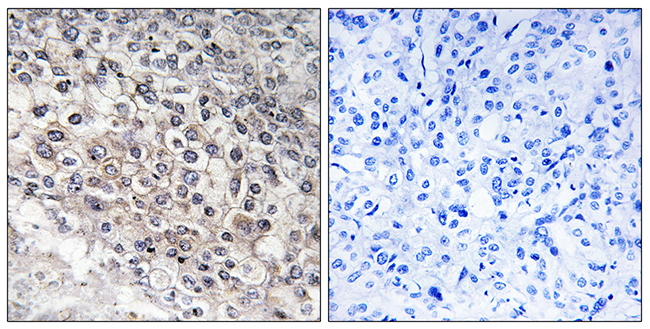 Anti-Cytochrome P450 2W1 Antibody