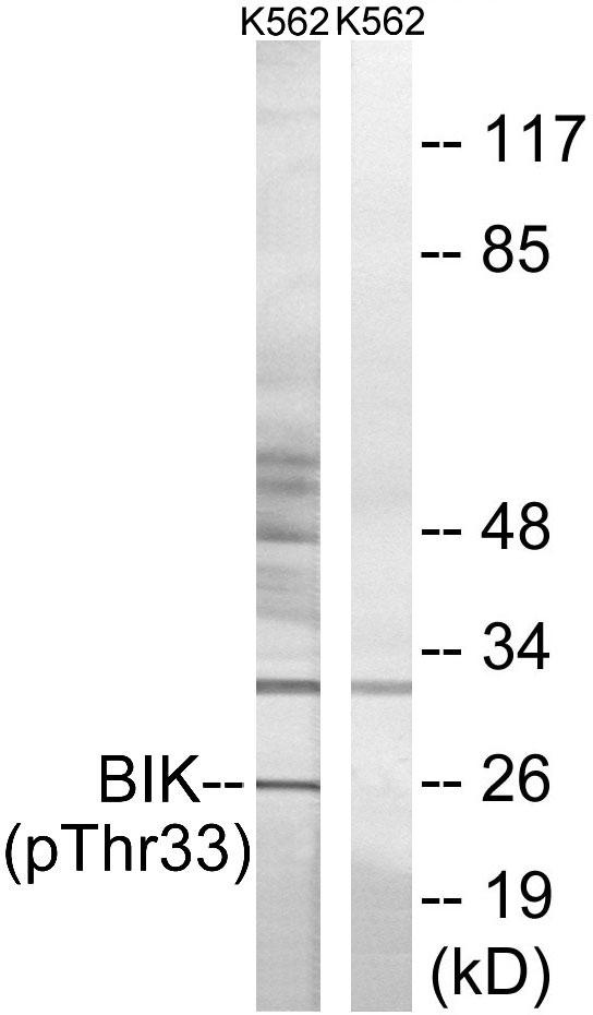 Anti-BIK (phospho Thr33) Antibody