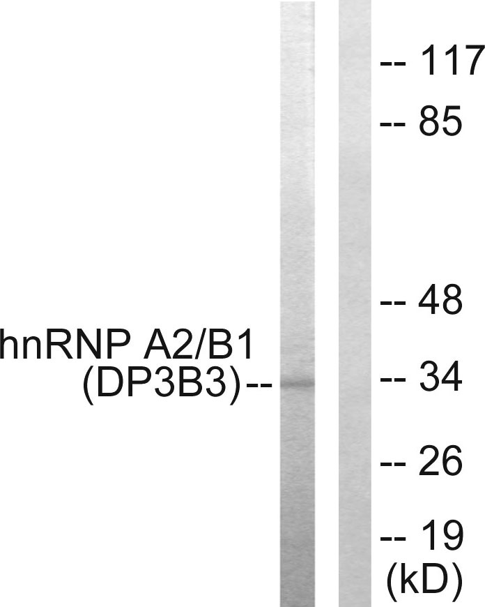 Anti-hnRNP A2 + B1 Antibody