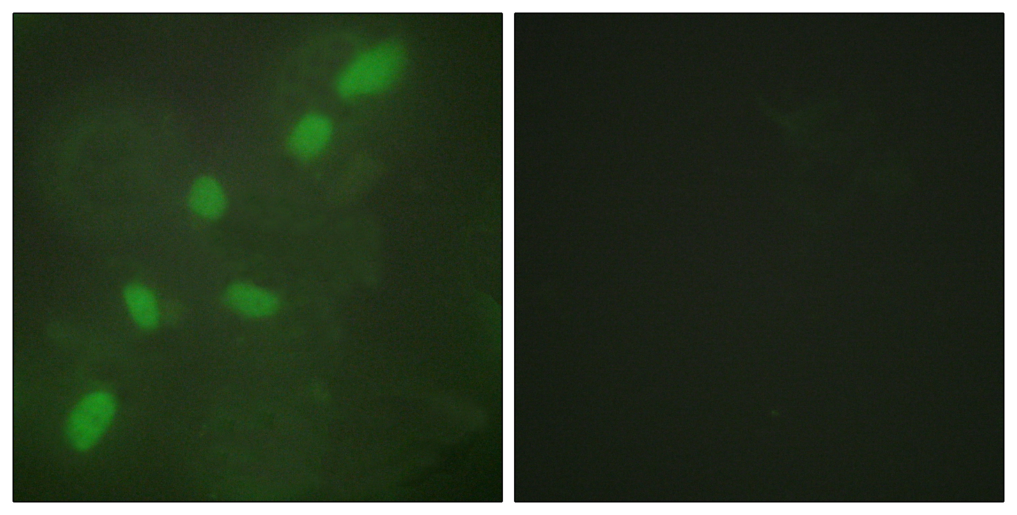 Anti-hnRNP A2 + B1 Antibody Anti-hnRNP A2 + B1 Antibody