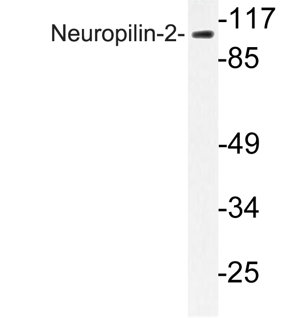 Anti-Neuropilin-2 Antibody