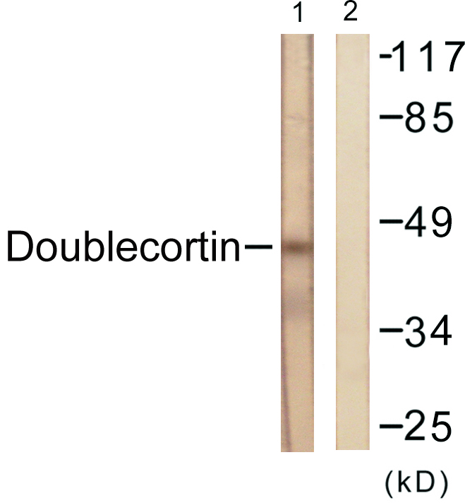 Anti-Doublecortin Antibody
