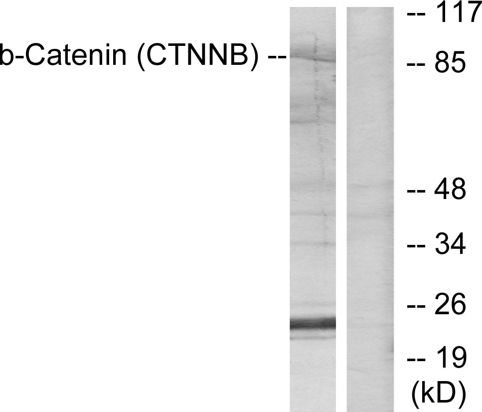 Anti-Catenin-beta Antibody