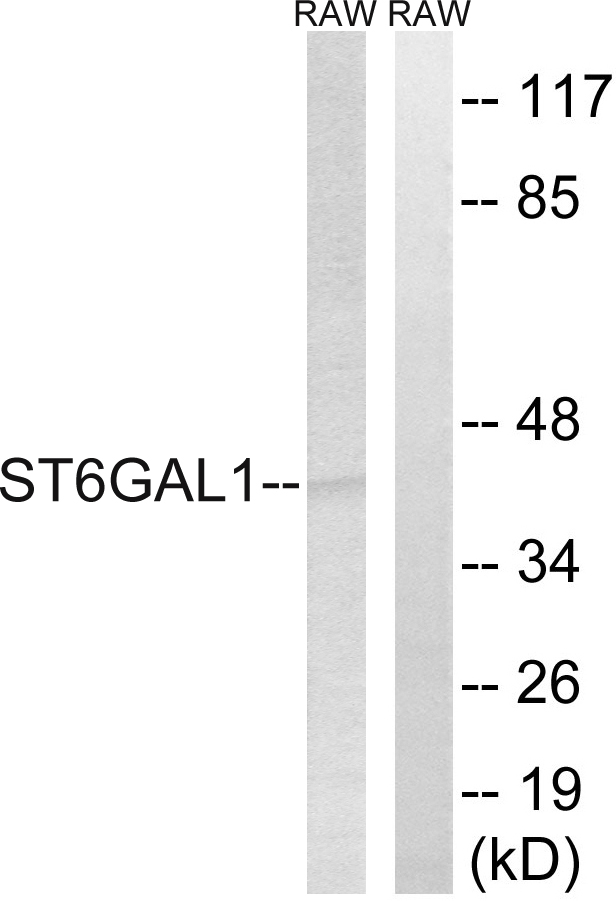 Anti-ST6GAL1 Antibody - Identical to Abcam (ab196890)