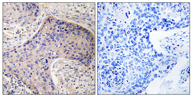 Anti-ST6GAL1 Antibody - Identical to Abcam (ab196890) Anti-ST6GAL1 Antibody - Identical to Abcam (ab196890)