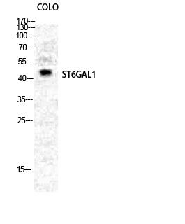 Anti-ST6GAL1 Antibody - Identical to Abcam (ab196890) Anti-ST6GAL1 Antibody - Identical to Abcam (ab196890)
