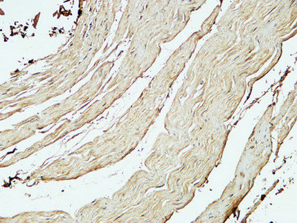 Anti-ST6GAL1 Antibody - Identical to Abcam (ab196890) Anti-ST6GAL1 Antibody - Identical to Abcam (ab196890)