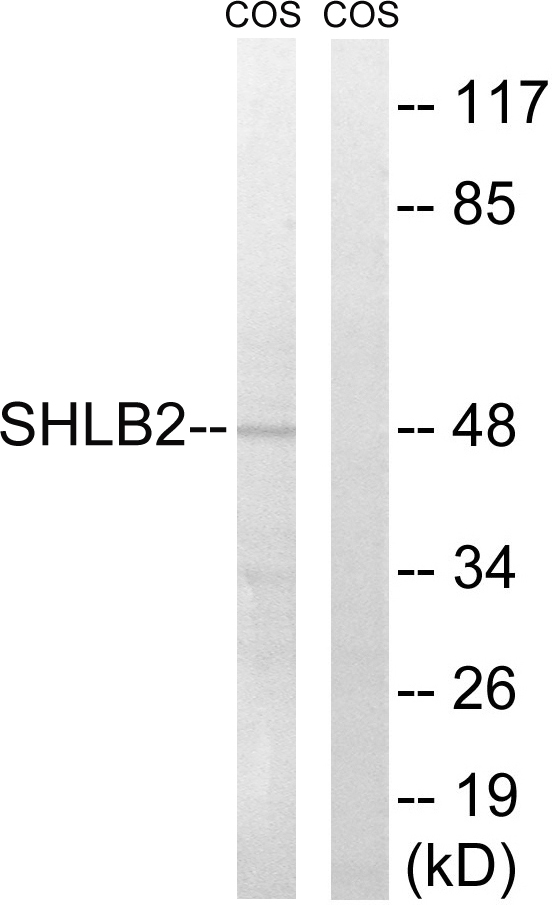 Anti-SH3GLB2 Antibody