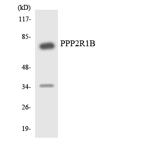 Anti-PPP2R1B Antibody