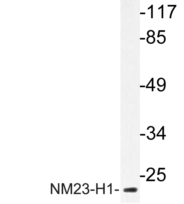 Anti-NM23-H1 Antibody