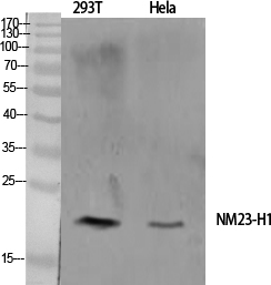 Anti-NM23-H1 Antibody Anti-NM23-H1 Antibody