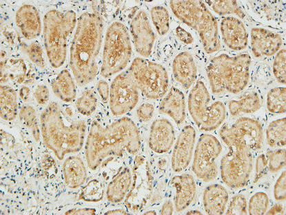 Anti-NM23-H1 Antibody Anti-NM23-H1 Antibody