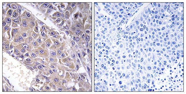 Anti-B4GALT3 Antibody