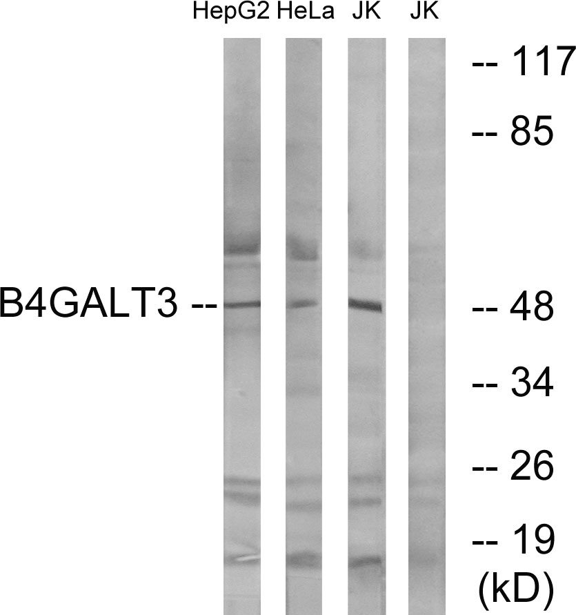 Anti-B4GALT3 Antibody Anti-B4GALT3 Antibody