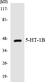 Anti-5-HT-1B Antibody