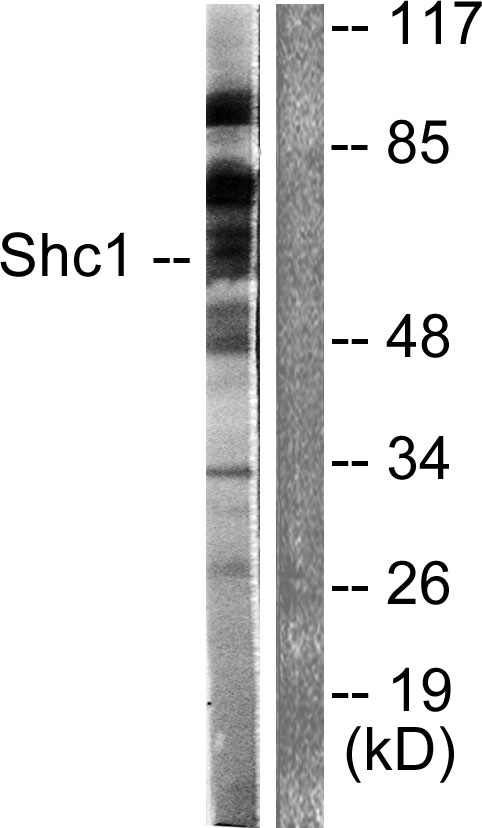 Anti-Shc Antibody