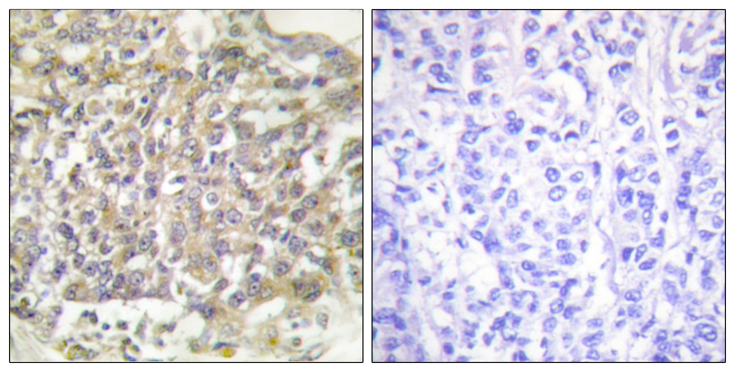 Anti-Shc Antibody Anti-Shc Antibody