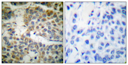 Anti-Shc Antibody Anti-Shc Antibody