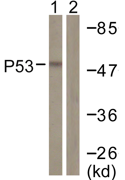 Anti-p53 Antibody Anti-p53 Antibody