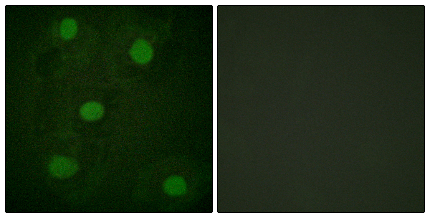 Anti-p53 Antibody
