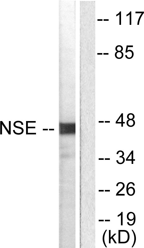 Anti-NSE Antibody - Identical to Abcam (ab53025)