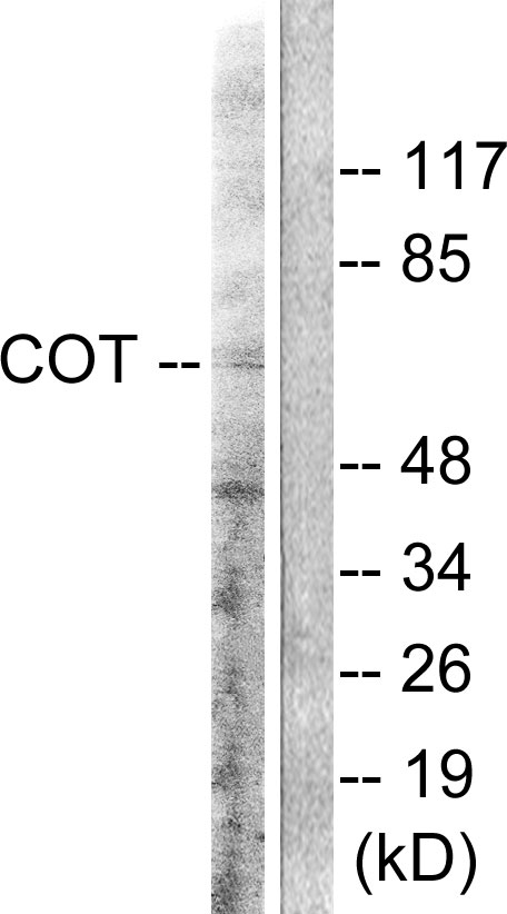 Anti-COT Antibody