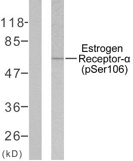 Anti-Estrogen Receptor-alpha (phospho Ser106) Antibody
