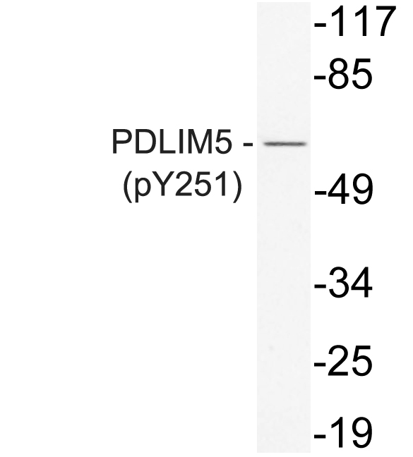Anti-PDLIM5 (phospho Tyr251) Antibody