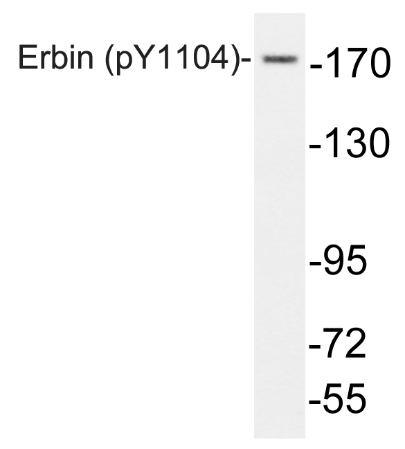 Anti-Erbin (phospho Tyr1104) Antibody
