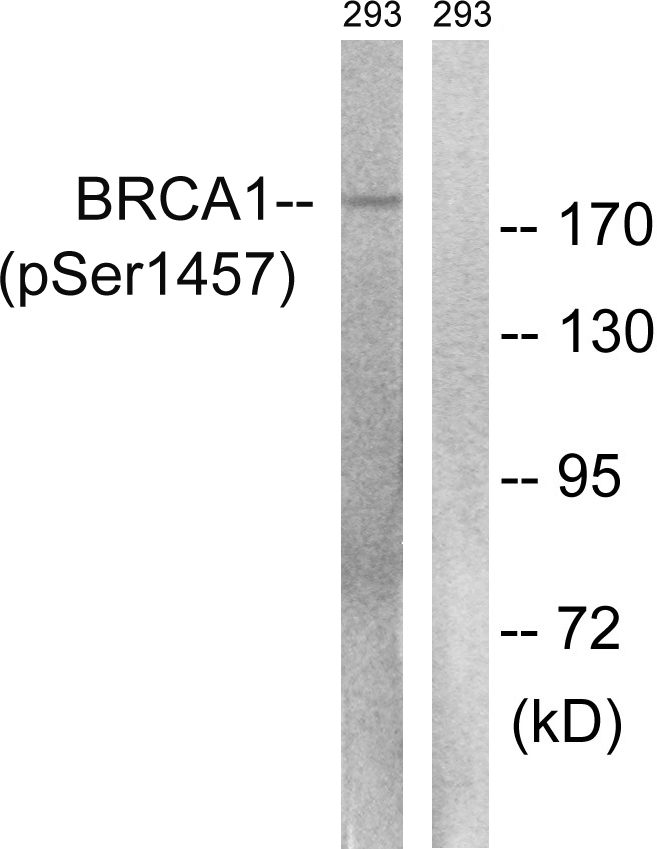 Anti-BRCA1 (phospho Ser1457) Antibody