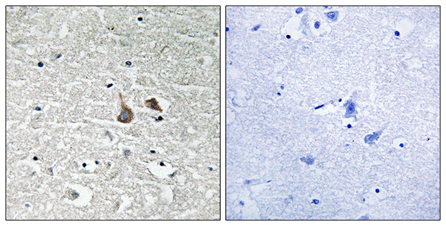 Anti-IRAK1 (phospho Ser376) Antibody