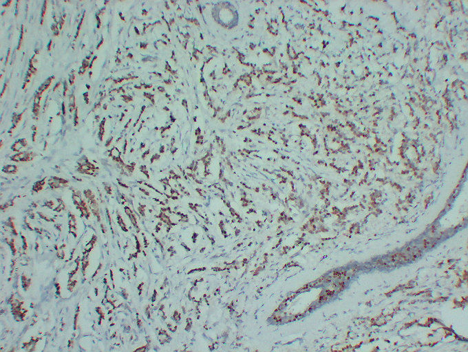 Anti-Progesterone Receptor Antibody [ABT-PR]
