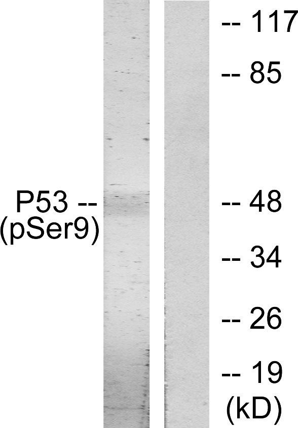 Anti-p53 (phospho Ser9) Antibody