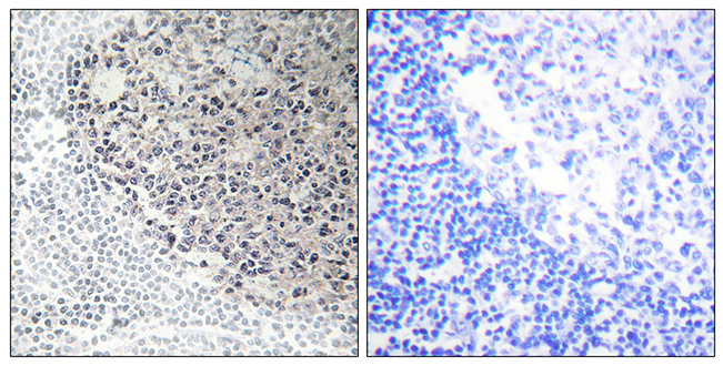 Anti-Collagen IX alpha3 Antibody - Identical to Abcam (ab196591) Anti-Collagen IX alpha3 Antibody - Identical to Abcam (ab196591)