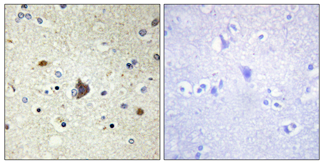 Anti-Collagen IV alpha3 Antibody - Identical to Abcam (ab111742) Anti-Collagen IV alpha3 Antibody - Identical to Abcam (ab111742)