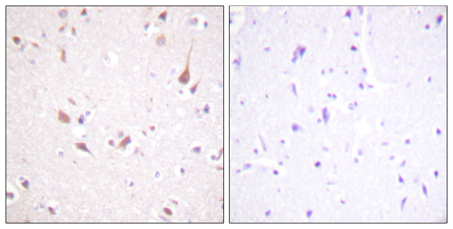Anti-Mst1 + Mst2 Antibody