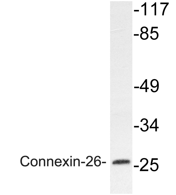 Anti-Connexin-26 Antibody