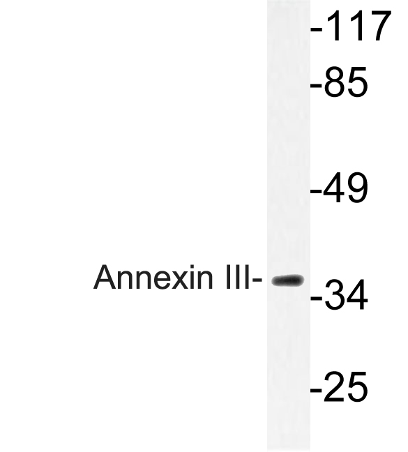 Anti-Annexin III Antibody