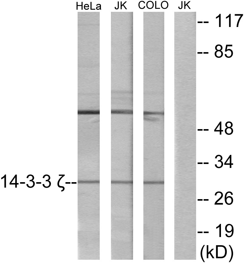 Anti-14-3-3 zeta Antibody