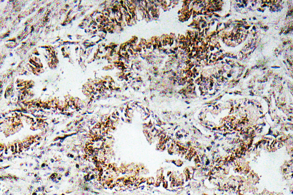 Anti-AChRalpha1 Antibody - Identical to Abcam (ab135272)