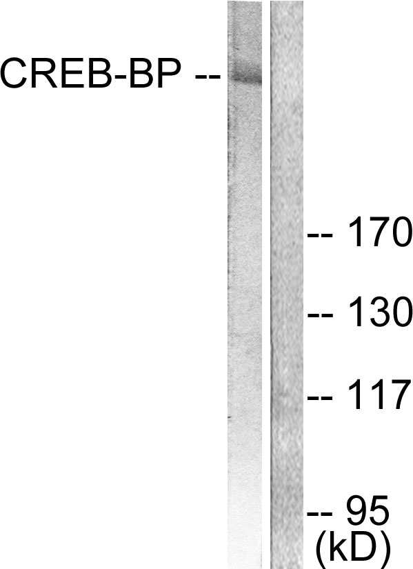 Anti-CREB-BP Antibody