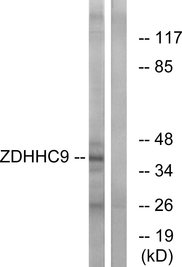 Anti-ZDHHC9 Antibody