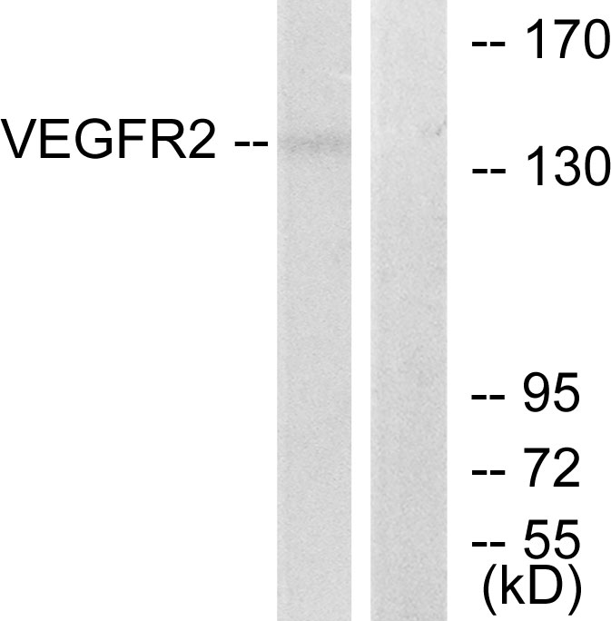 Anti-VEGFR2 Antibody