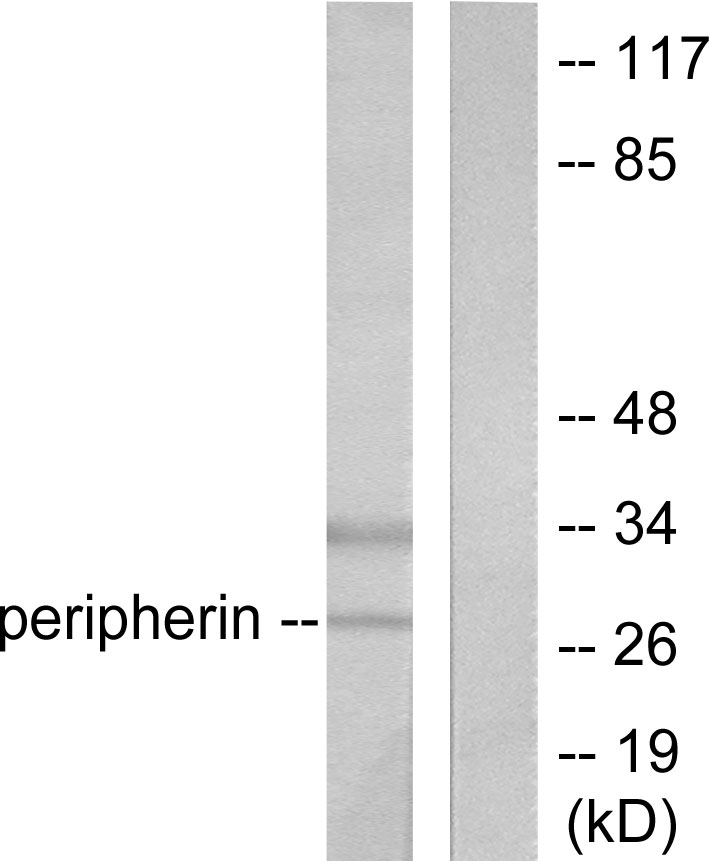 Anti-PGP9.5 Antibody