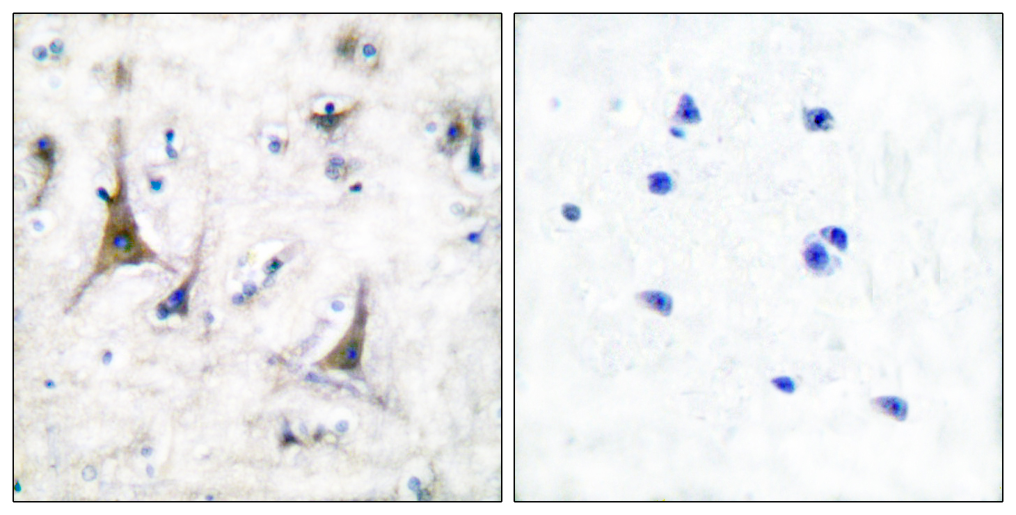 Anti-PGP9.5 Antibody Anti-PGP9.5 Antibody
