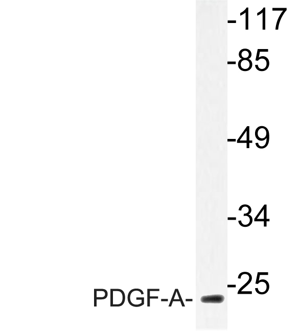 Anti-PDGF-A Antibody