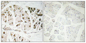 Anti-Nogo A Antibody Anti-Nogo A Antibody