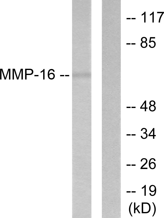 Anti-MMP-16 Antibody - Identical to Abcam (ab53145)