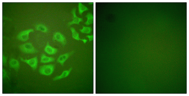 Anti-MMP-10 Antibody - Identical to Abcam (ab59437)